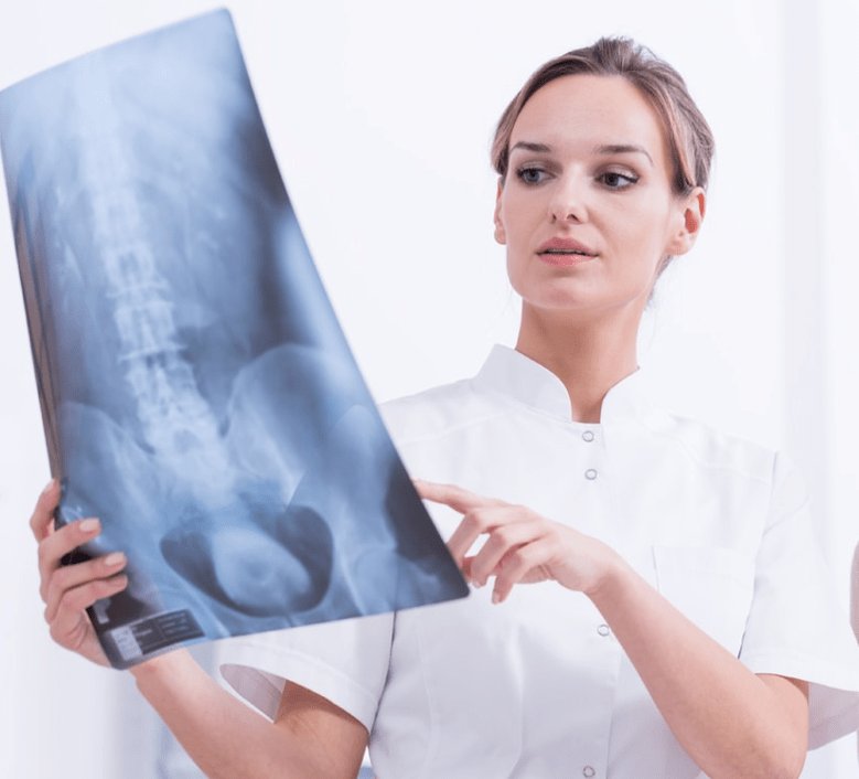 X-ray examination to diagnose thoracic osteochondrosis