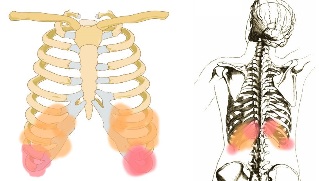 back pain below the ribs symptoms