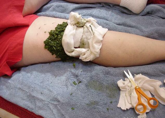 Arthritic knee joint pain with warm compress of crushed cabbage leaves
